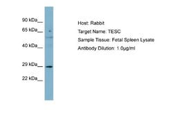 tescalcin Rabbit anti-Human, Polyclonal, Novus Biologicals 0.1ml; Unconjugated:Antistoffer